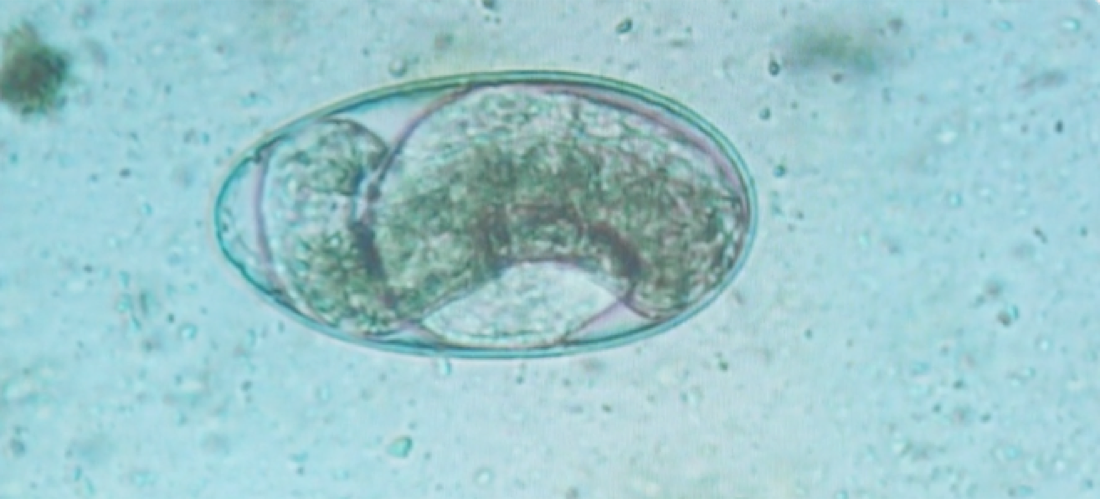 Wurmei einer Hühnerprobe unter dem Mikroskop